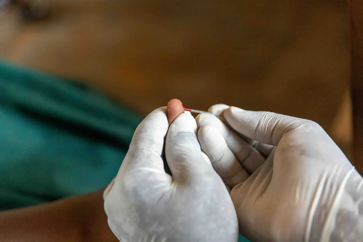 A clinician examining a child’s hand